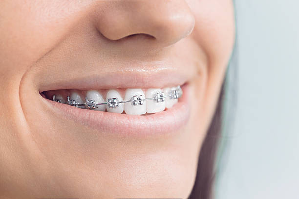 Full Mouth Reconstruction in Queen Anne, MD